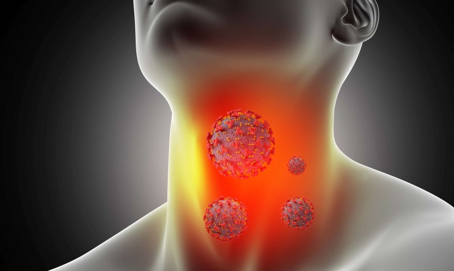 سرطان الحلق