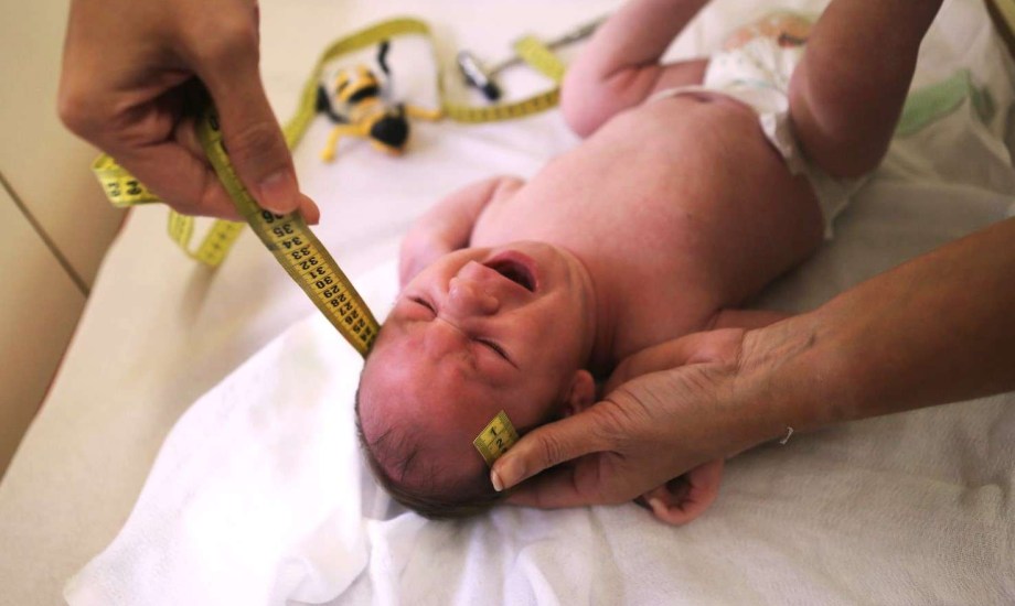 صغر حجم رأس الرضيع