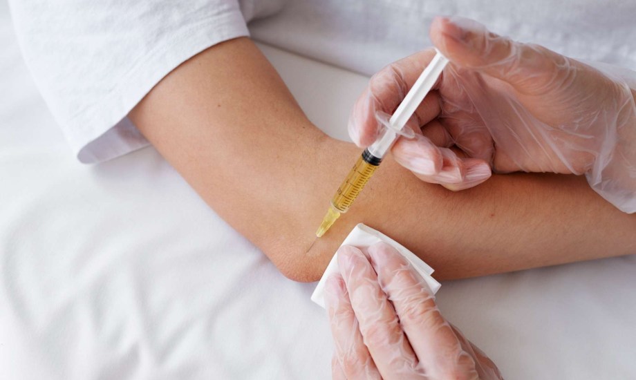 حقن البلازما