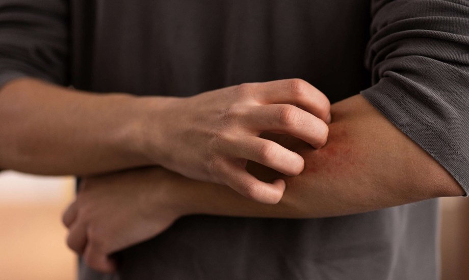 إصابة جلدية