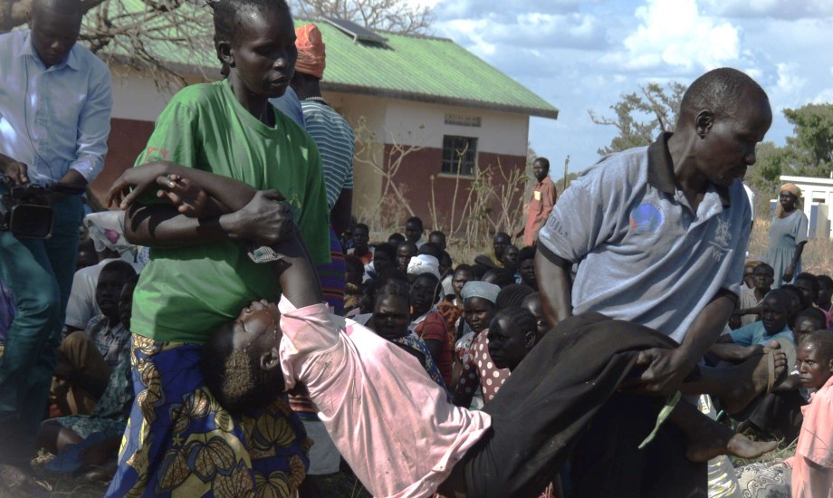 انتشار متلازمة الإيماء بين أطفال إفريقيا