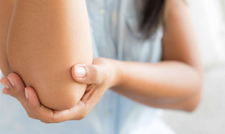 التهاب المفاصل