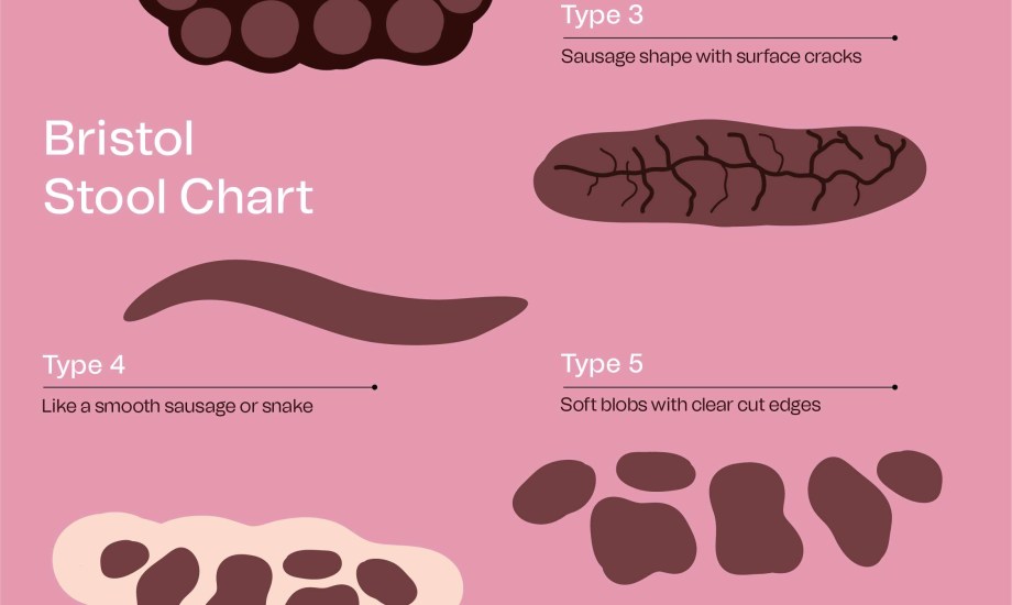 لون وشكل برازك يكشف حالتك الصحية