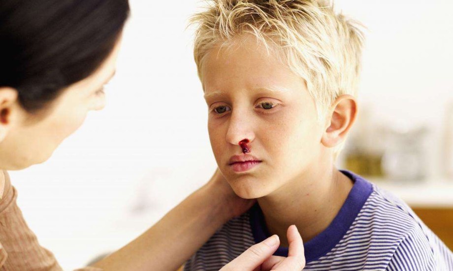 نصائح للوقاية من نزيف الأنف