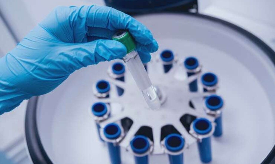 شفاء أول مريض بالسكري