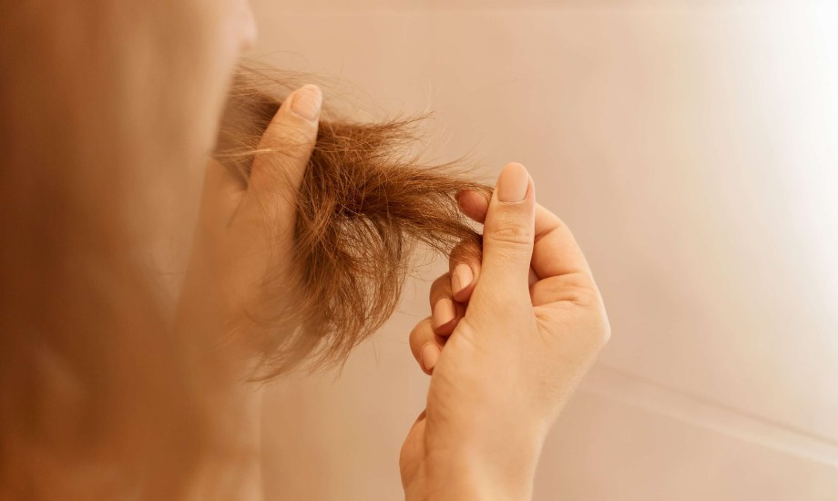 تساقط الشعر بعد الولادة