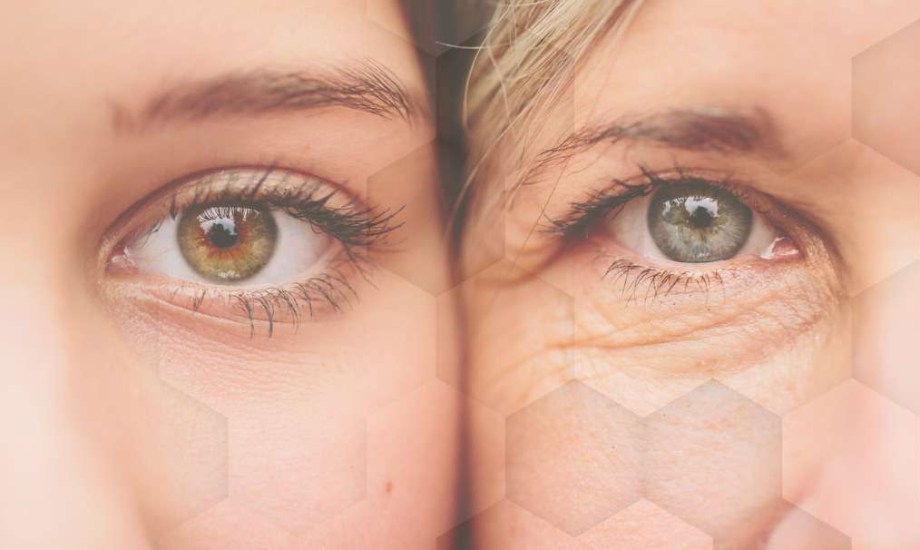 ظهور التجاعيد