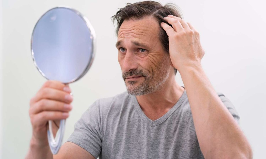 هل ضغوط العمل تؤدي إلى مشاكل الشعر الخطيرة؟