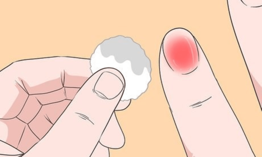 الأصبع المدوحس