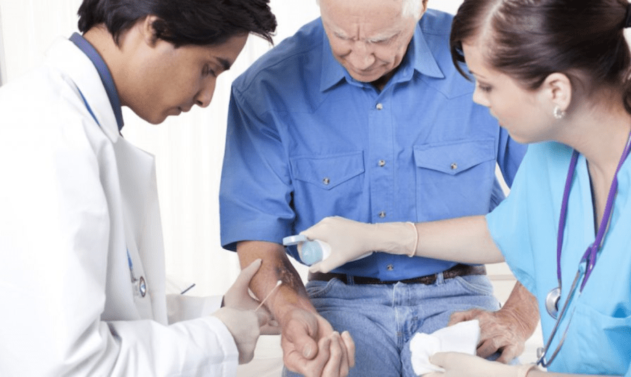 علاقة النظام الغذائي الصحي والشفاء من الحروق