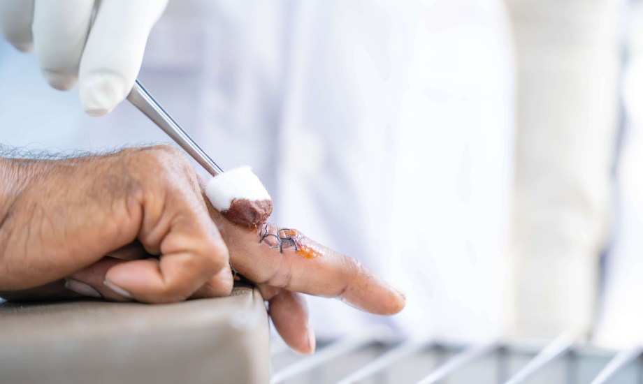 أطعمة تسرع وتيرة الشفاء بعد الجراحة