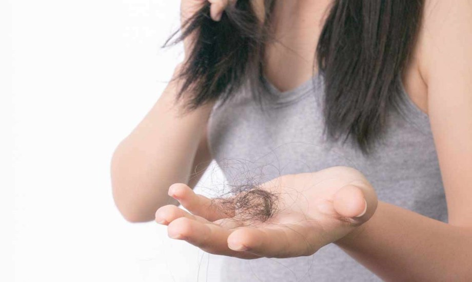 الكشف المبكر عن تساقط الشعر والصلع