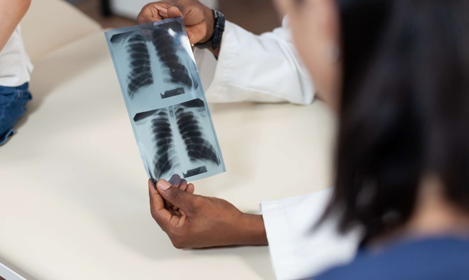 أسباب انتفاخ الرئتين