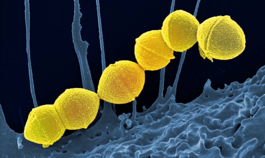 بكتيريا المكورات العقدية