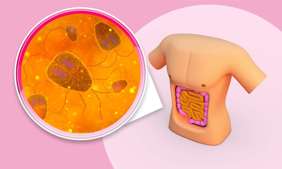 سرطان البنكرياس