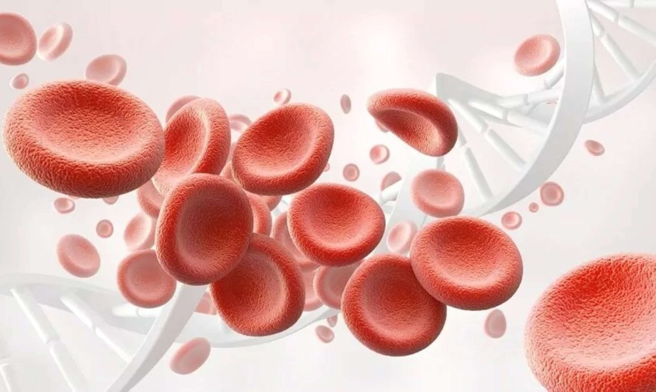 أسباب الأنيميا وطرق العلاج والوقاية