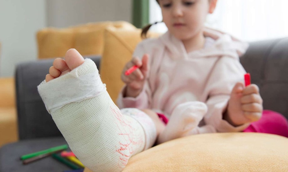 نائح فعالة تساعد على علاج كسور العظام لدى الأطفال 