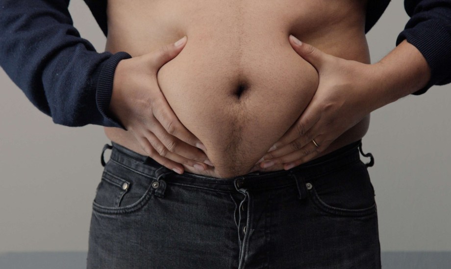 أسباب تراكم الدهون تحت الجلد