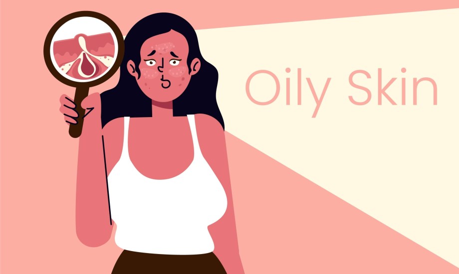 نصائح للتعامل مع البشرة الدهنية