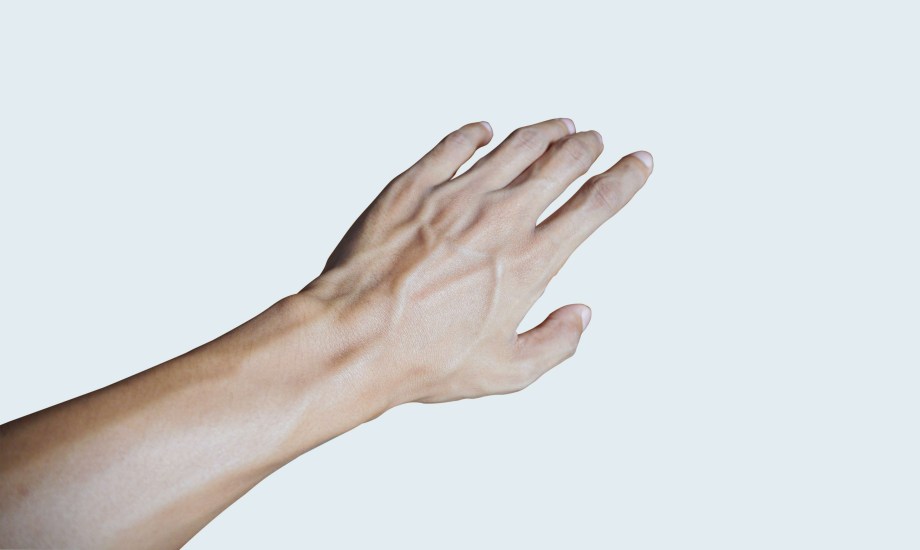 أسباب انتفاخ عروق اليد