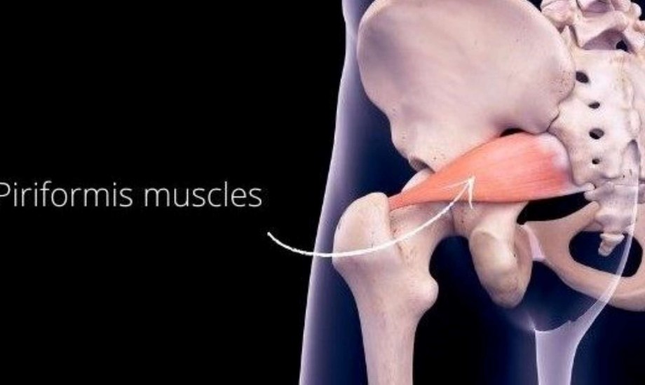 أسباب وأعراض متلازمة الكمثرى