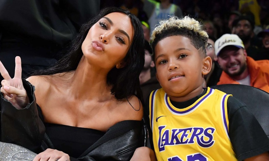 إصابة نجل كيم كارداشيان بالبهاق