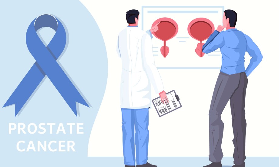 نصائح لمنع تطور سرطان البروستاتا
