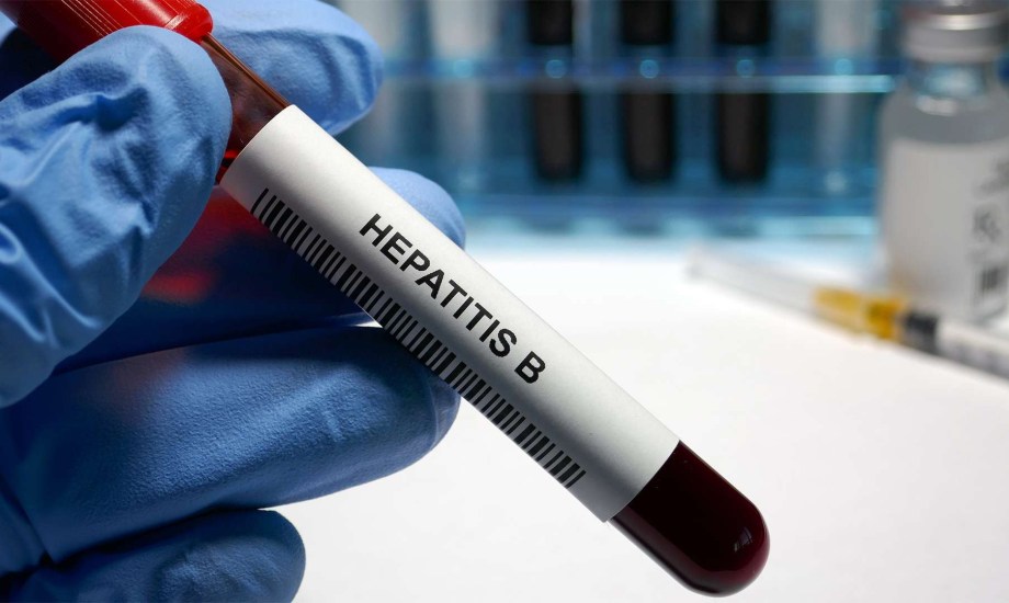 أطعمة ضرورية لعلاج التهاب الكبد B