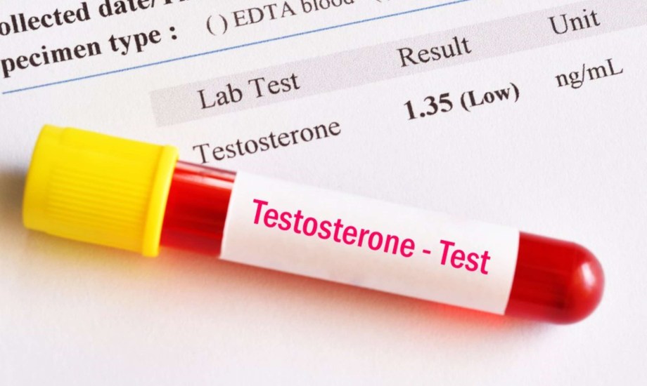 مخاطر الصيام المتقطع على هرمون التستوستيرون
