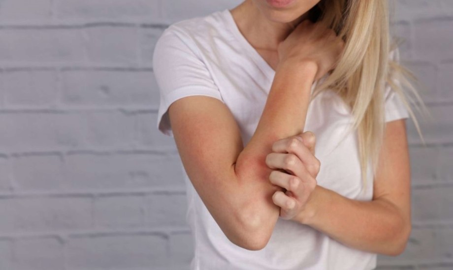 أسباب للإصابة بحساسية الجلد