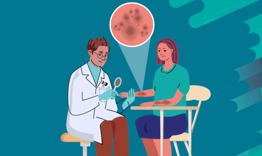 عوامل تزيد خطر إصابة مرضى السرطان بالعدوى الفطرية