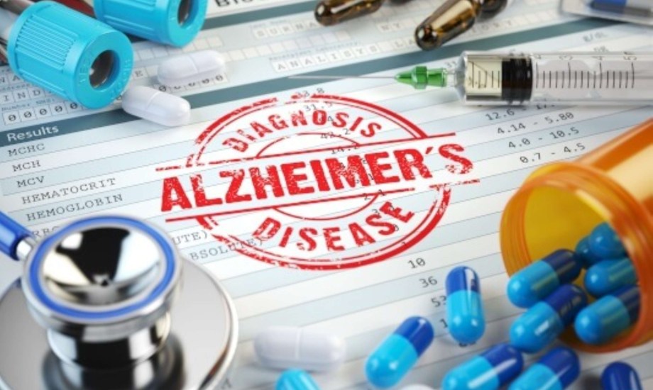 دواء جديد لعلاج مرض ألزهايمر
