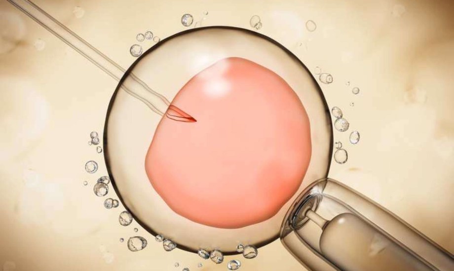 التشريعات القانونية عقبة في طريق تطور التلقيح الاصطناعي