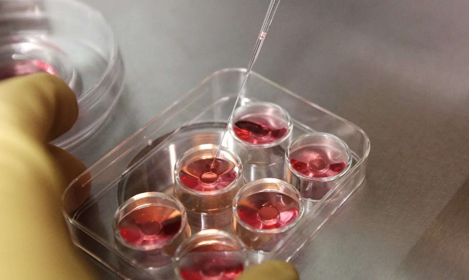 لماذا تلجأ النساء إلى تجميد البويضات؟