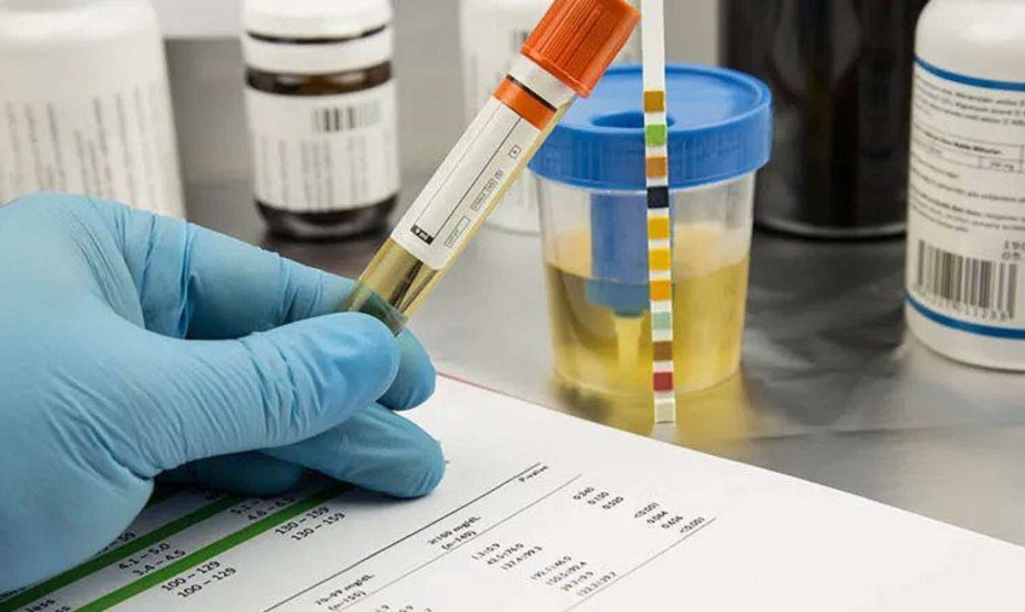 أدوية تسبب إيجابية اختبار المخدرات