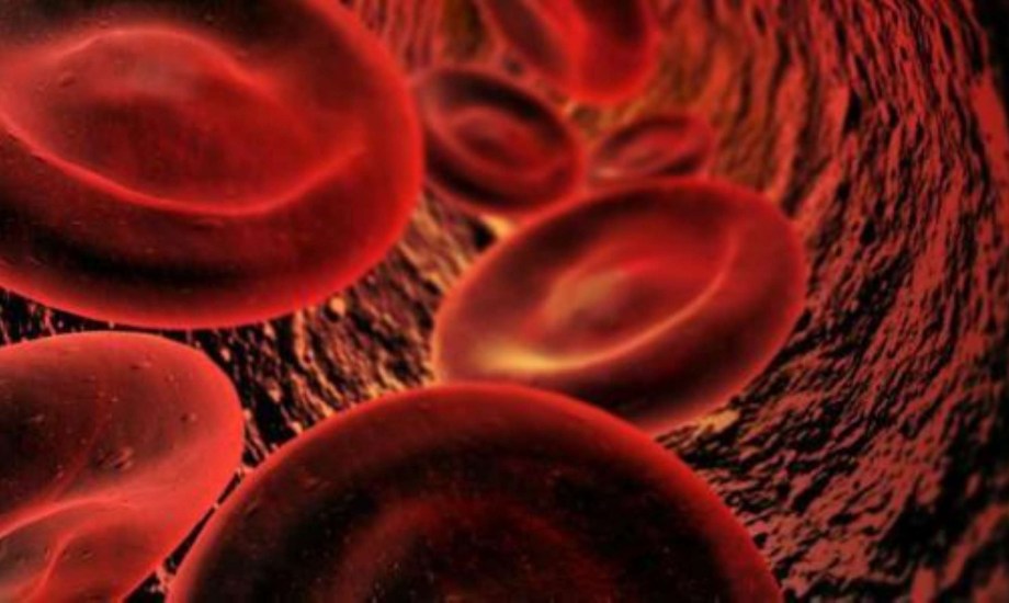 أسباب وأعراض نقص الصوديوم في الدم