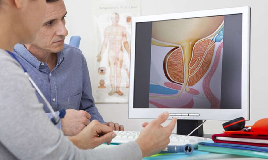 فوائد خزعة البروستاتا