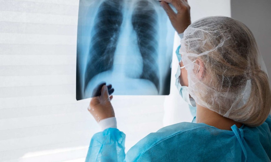 مشاكل صحية تؤثر على رئة الرجال