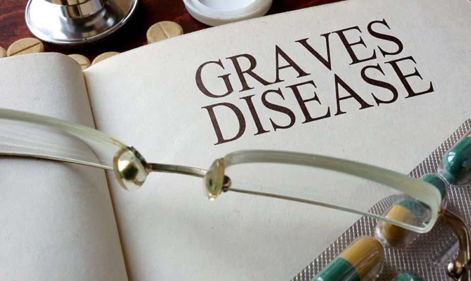 أعراض الإصابة بمرض جريفز