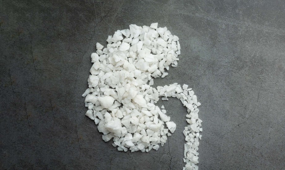 هل يمكن العيش بكلية واحدة؟