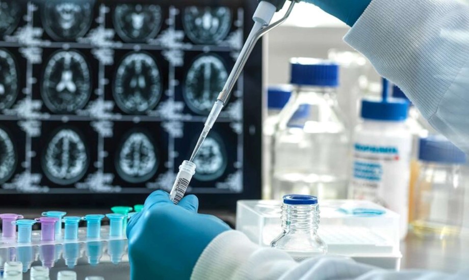 أدوية ألزهايمر