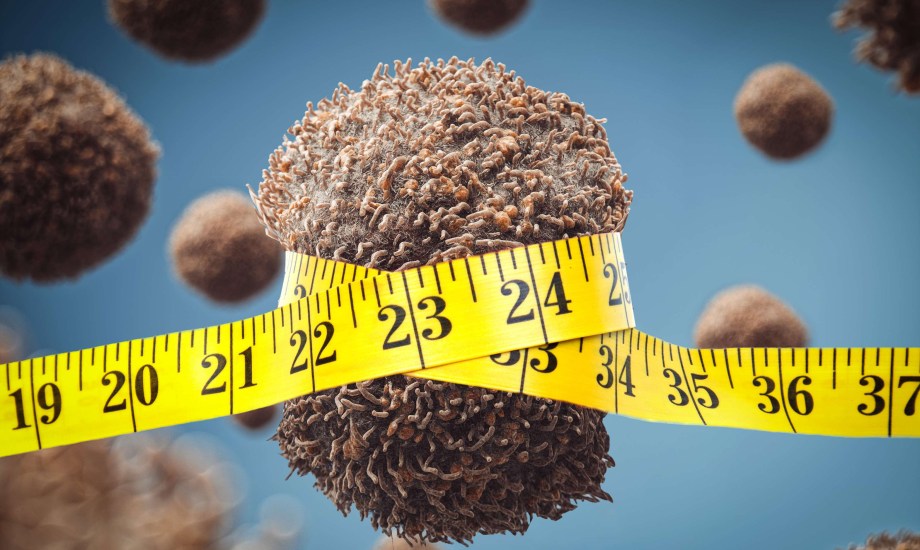 ما علاقة نظام كيتو بالوقاية من سرطان البنكرياس؟