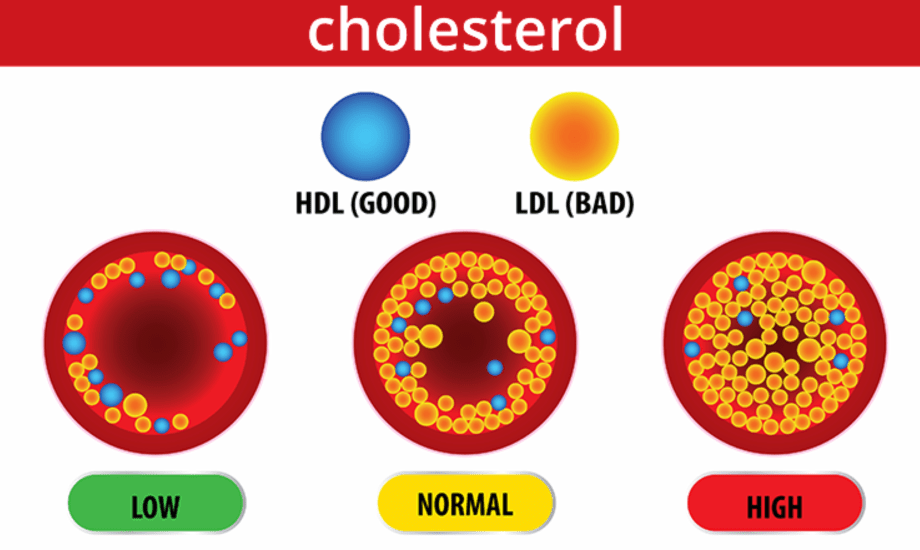 تمارين الكارديو والمقاومة للكوليسترول الضار 