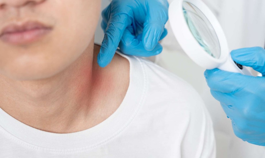 أسباب ظهور بقع بنية على الرقبة