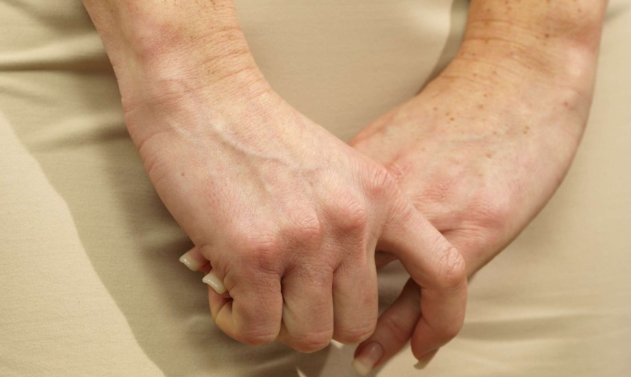 8 طرق طبيعية وطبية لعلاج تجاعيد اليدين.. هل جربت حقن الدهون؟