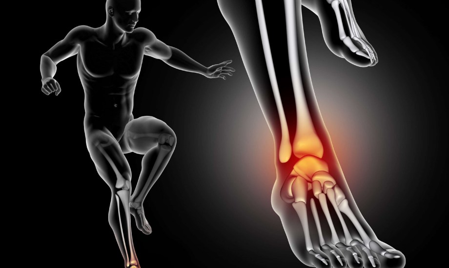التهاب وتر أكيلس.. أنواعه و4 أعراض تكشف الإصابة