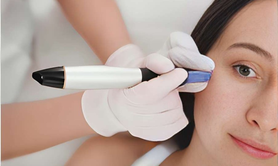 الوخز بالإبر الدقيقة لتحفيز الكولاجين 