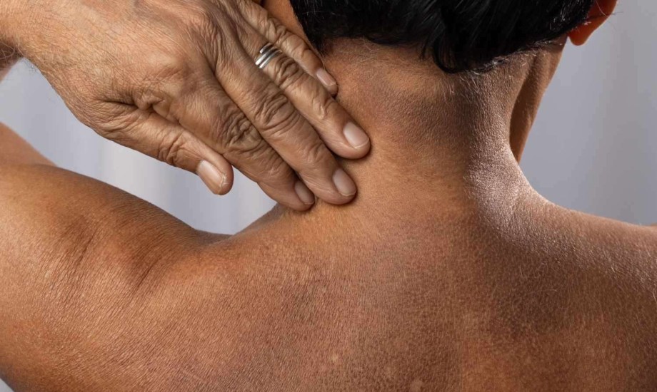 طرق فعالة لعلاج التينيا منزلياً