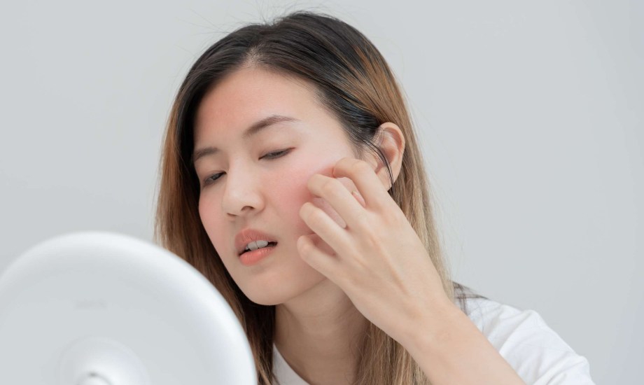 هل تعاني من تورم الوجه؟ تجنب 5 أطعمة