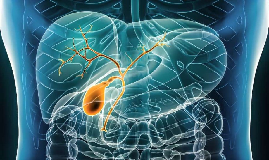 أسباب انسداد القناة الصفراوية